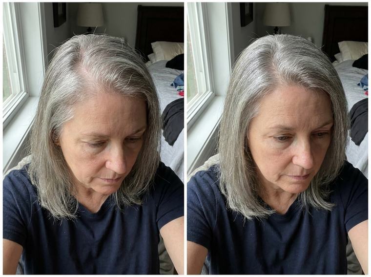 Sandra M. — before and after using FST-5