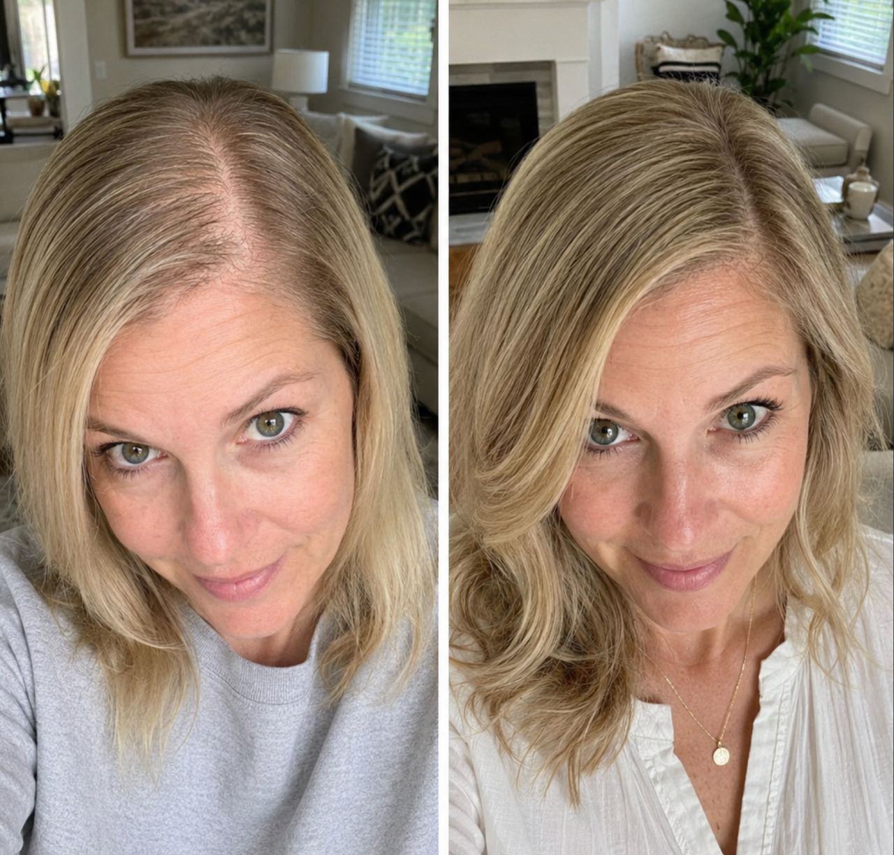 Before and after four weeks of FST-5
