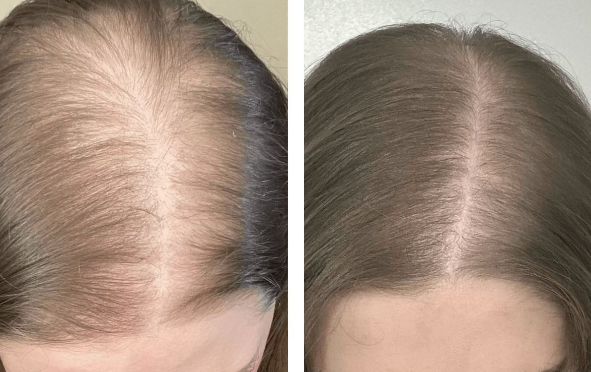 A woman with long, full hair