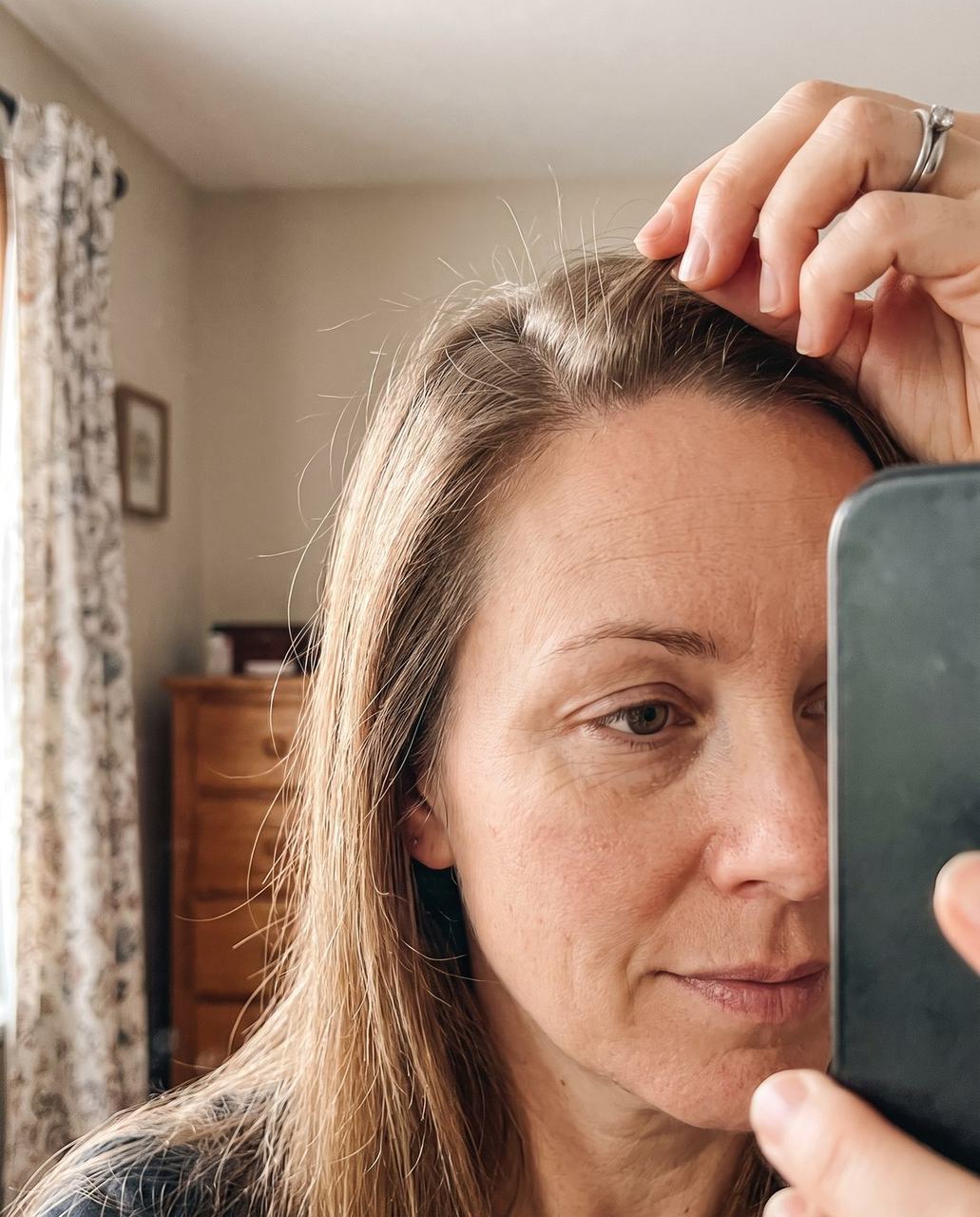 Weeks two to four: short new hairs standing up along the part line