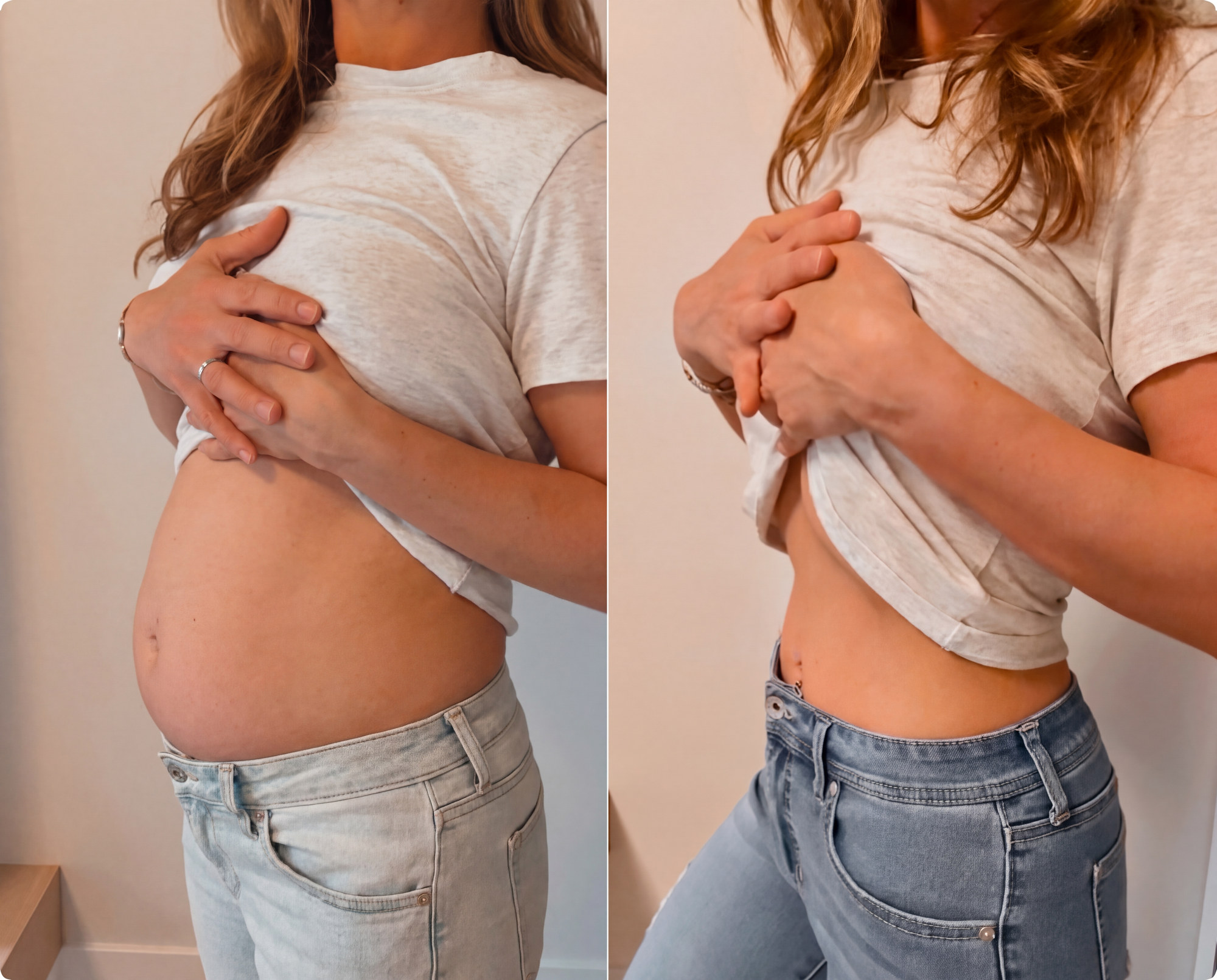 Before and after