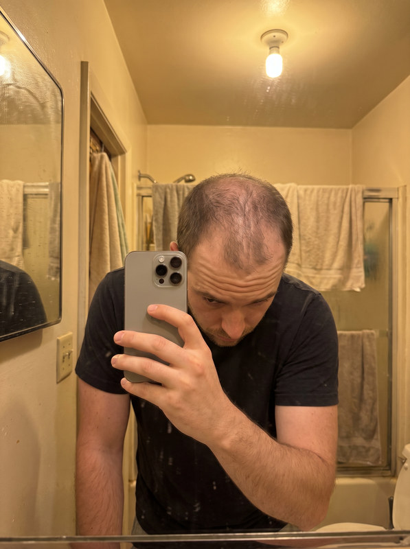 Stage 2